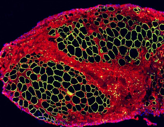 Regenerating Muscle